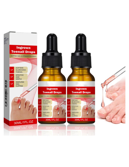 Kit 2 gotas para uñas encarnadas AUJ 10ml - Alivio y suavización Kit 2 gotas para uñas encarnadas AUJ 10ml - Alivio y suavización