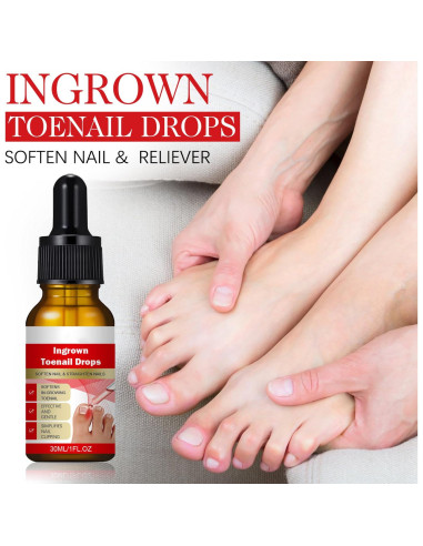 Kit 2 gotas para uñas encarnadas AUJ 10ml - Alivio y suavización