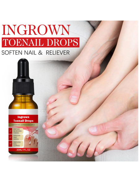 Kit 2 gotas para uñas encarnadas AUJ 10ml - Alivio y suavización Kit 2 gotas para uñas encarnadas AUJ 10ml - Alivio y suavización