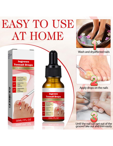 Kit 2 gotas para uñas encarnadas AUJ 10ml - Alivio y suavización Kit 2 gotas para uñas encarnadas AUJ 10ml - Alivio y suavización